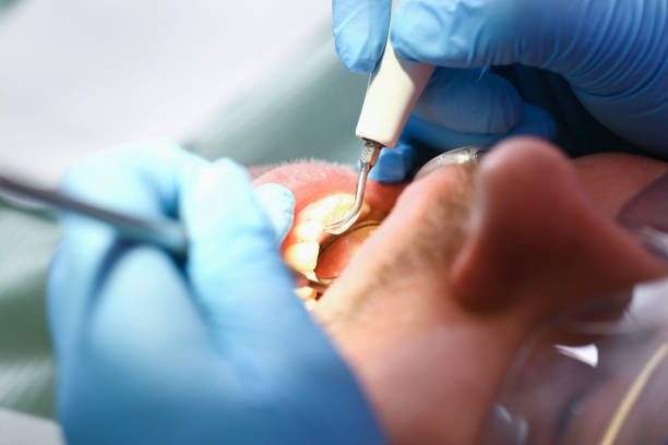 Best Weekend Emergency Dentist in Dalton, GA