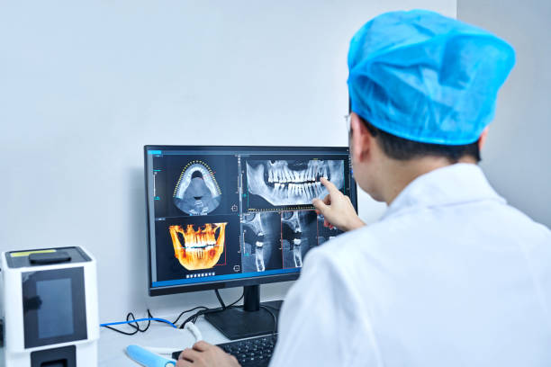 Best Emergency Root Canal Treatment in Dalton, GA